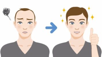 HOW TO HIDE THE BIG FOREHEAD Youth Hairstyles to Hide Wide Forehead Bangs